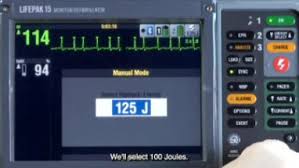 Image result for Synchronized Cardioversion