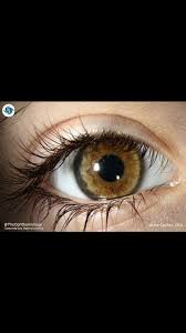 Image result for melanosis sclera
