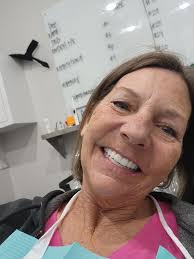 Bionic Smile Procedure Experience and Recommendations