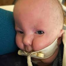 Fundraiser for Robin Melvin by Lori Alonzo : Baby Vinny Edward Syndrome  Warrior