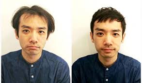 m字ハゲを自然に隠す髪型16選 男の薄毛を熟知した美容師のヘアカタログ aga エージーエープラス メンズ ヘアスタイル 薄毛 薄毛ヘアスタイル