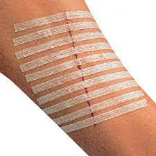Burn for burn, wound for wound, bruise for bruise. Steri Strip Wundverschlussstreifen Klammern Wundnahtstreifen Wundverschluss Verbandstoffe Doccheck Shop Dein Medizinbedarf Online