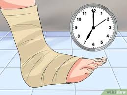 Simplest taping technique ever for plantar fasciitisthis video is a part of a series of videos on how to treat plantar fasciitis on your own. 3 Ways To Tape A Foot For Plantar Fasciitis Wikihow