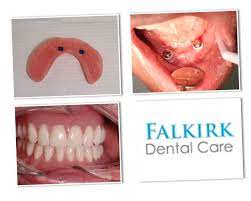 Patient Came In Today With A Loose Lower Denture They Couldn T Eat Or Chew And It Was A Great Inconvenience To Them Could We Denture False Teeth Implants