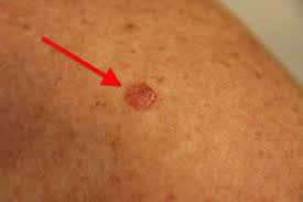 Pin On Medical
