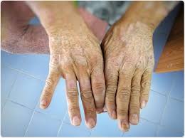 Image result for Scleroderma geaster