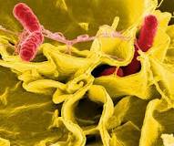 Image result for icd 10 code for salmonella enteritidis