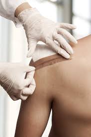 Tattoos are cool, fun, and sexy. Aftercare Tips Vanish Laser Clinic Alexandria Va