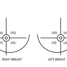 Clinical anatomy of the breast. Breast Quadrants Definition Upper Outer Uoq Upper Inner Uiq Download Scientific Diagram