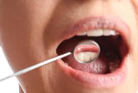 Image result for gum cancer symptoms