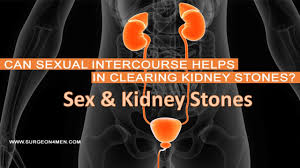 Sex And Kidney Stones Youtube