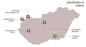 Suchen auf der karte bad thermen (17), balaton touristische stellen (8), parks (6), schlösser (5), seen (6), skigebiete (4), städte (18), weinstraße (9). Zahnklinik In Budapest Und Zahnklinik In Heviz Renommierte Zahnarzte Bei Zahnklinik Ungarn De