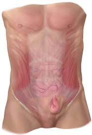 A catheter is inserted into the femoral artery in the groin and threaded into the coronary arteries. Conditions We Treat Inguinal Hernia