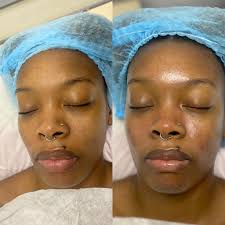 Free Waxing Services in Pearland by Licensed Esthetician