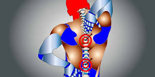 Image result for Myelitis