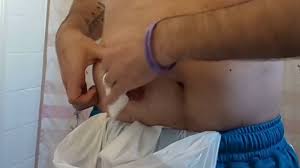 Use an opaque pouch or try a pouch cover. How To Change An Ostomy Appliance W Video Veganostomy