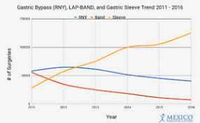 gastric sleeve surgery complete guide 2018 obesity reporter