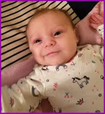 Hi all my baby boy has been diagnosed with craniosyntosis, his metopic  suture is fused. We had a CT scan a few weeks back but haven't yet heard  anything, how long do