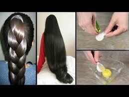 как избавиться от перхоти и выпадения волос в домашних условиях Domashnyaya Maska Dlya Volos Ne Tolko Izbavit Vas Ot Perhoti I Zuda No I Ukrepit Korni Volos I Vernet Volosam Zd V 2020 G Domashnie Maski Dlya Volos Maski Dlya Volos Volosy