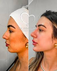 PRETTY FACE 😍 Un protocolo completamente personalizado para cada paciente.  Citas vía WhatsApp 321-812-9594