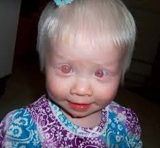 Pin Di Bonnie Cook Su Aberrant Albino Animals Bambini Foto