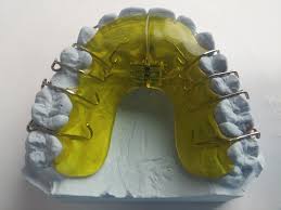 Some orthodontists prefer using fixed retainers, which are wires that are glued to the bakcs of teeth, and hold front teeth together. You Have To Wear Your Retainer Just Had Your Braces Removed After Many By Bensonhurst Dental Forever Young Medium