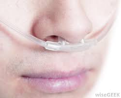 Why choose nasal cannulas over oxygen masks? What Is A High Flow Cannula With Pictures