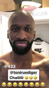 He was soon promoted to the main vfb stuttgart team and he made an instant. Antonio Rudiger Has Gone Bald Chelseafc