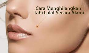 Cara menghilangkan tahi lalat dengan alami bisa anda coba di rumah. Cara Menghilangkan Tahi Lalat Secara Alami Klinik Pulowatu