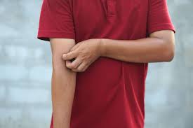 Image result for svrab na k%u016F%u017Ei