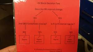 Heart Block Flowchart The Nursing Era