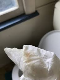 Jun 25, 2021 · the mucus plug is a clear, sticky, gelatinous glob of mucus. I M 8 Weeks Postpartum An Just Had Some Discharge With Pink Blood It It December 2017 Babycenter Australia