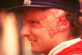 Einen furchtbaren unfall hatte niki lauda auf dem nürburgring 1976. Matematico Aumentare Puo Essere Ignorato Niki Lauda Vor Unfall Eccentrico Posizione Fai Un Esperimento