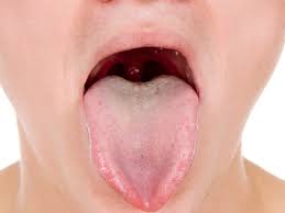 Image result for brown tongue symptoms