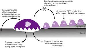 Image result for Bisphosphonates