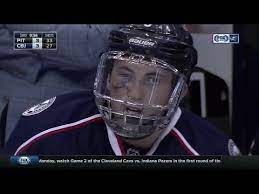 Ice hockey star zach werenski takes puck to the face, pours with blood. Zach Werenski Took Puck To Face Got Stitches And Returned In Same Game Youtube