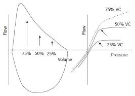 pitfalls in spirometry clinical relevance