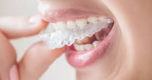 You may be wondering how to know if you need braces, so we've put together a list. Why Your Teeth Are Crooked After Years Of Braces The Orthodontists