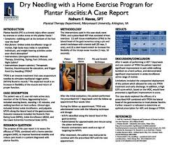 Dry Needling With A Home Exercise Program For Plantar Fasciitis A Case Report The University Library Archives