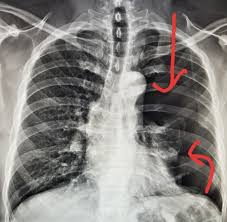 Pin On Nursing Stuff