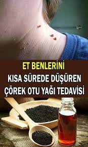 et benleri icin corek otu yagi tedavisi sosyolife net otlar saglikli yasam tarzi dogal saglik