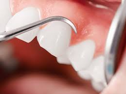 Holistic Dentistry Whole Health Dentistry