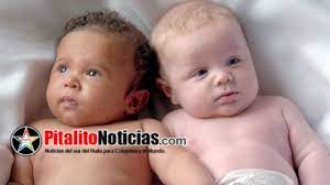 Nacen Mellizos De Diferentes Padres En Colombia
