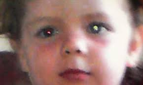 Facebook saves girl's life after family friend spots eye cancer