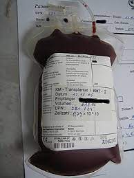 Recent papers in hematopoietic stem cell transplantation. Hematopoietic Stem Cell Transplantation Wikipedia