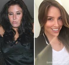 65 Before And After Pics Show What Happens When You Stop Drinking Part 2 Bored Panda
