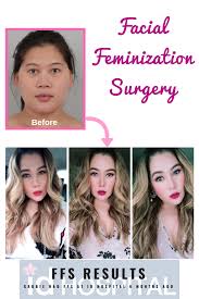 Ffs Results Id Hospital Korea