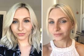 How To Bleach Your Roots To White Blonde Without Breakage - Hair Tutorial -  Youtube