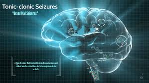 The brain's nerve cells normally but sometimes, grand mal seizures can be triggered by other health problems, such as extremely low blood sugar, a high fever or a stroke. Tonic Clonic Seizures By Makenzi Edwards On Prezi Next