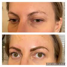 Redheads require extra...